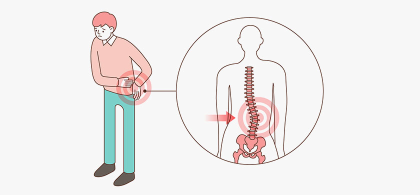 척추측만증 사진
