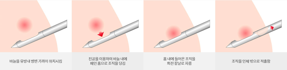 맘모톰 사진