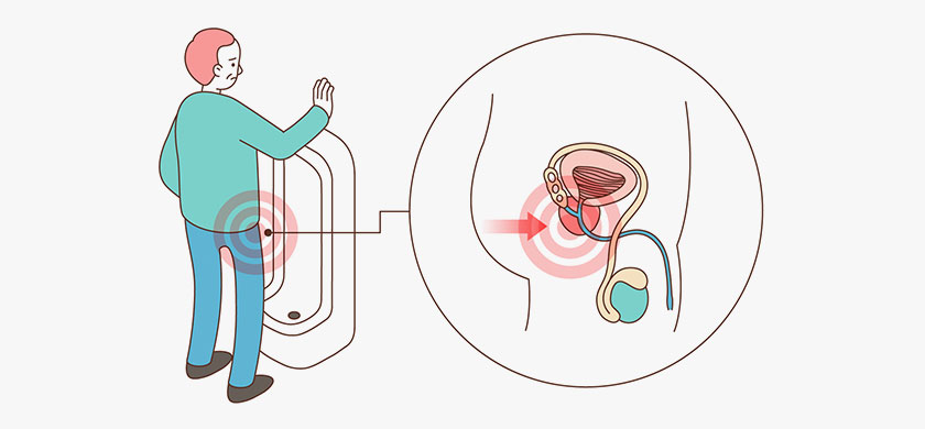 전립선비대증 사진